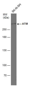 ATM Antibody (2C1)