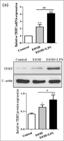 TERT Antibody (2C4)