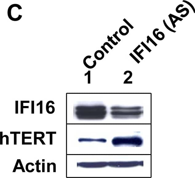 TERT Antibody (2C4)