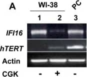 TERT Antibody (2C4)