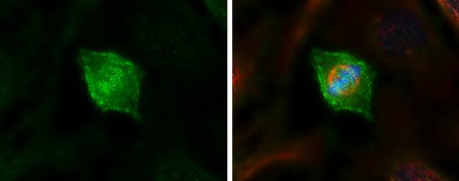 NDC80 Antibody (9G3.23)