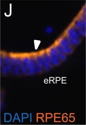 RPE65 Antibody (401.8B11.3D9) - BSA Free