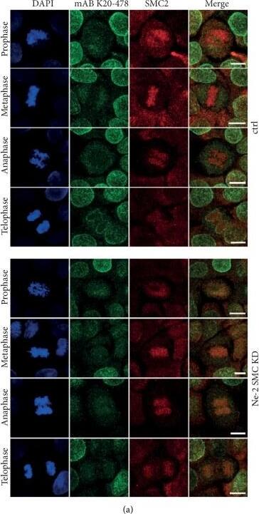SMC2 Antibody - BSA Free