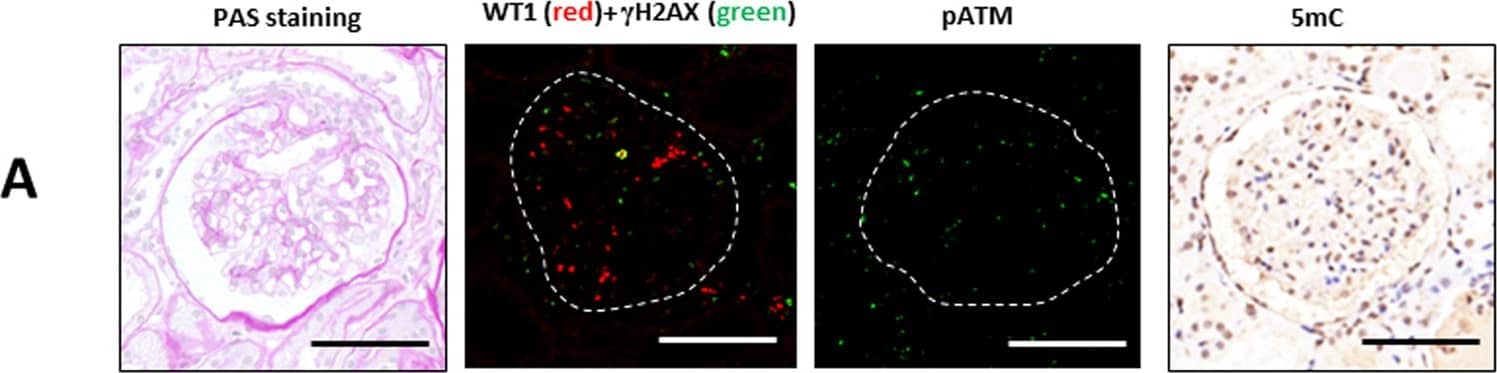 Histone H2AX [p Ser139] Antibody