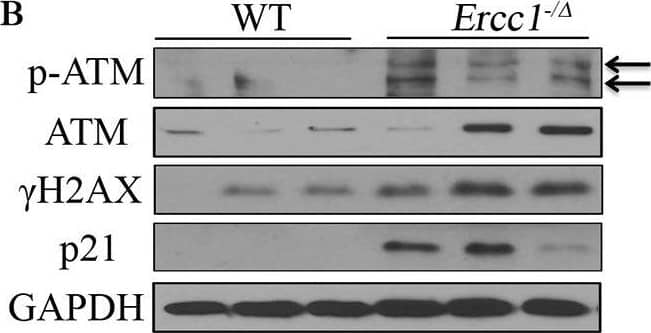 Histone H2AX [p Ser139] Antibody
