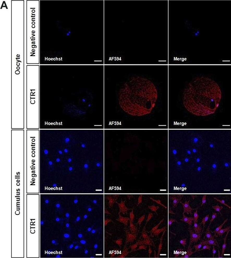 SLC31A1/CTR1 Antibody - BSA Free