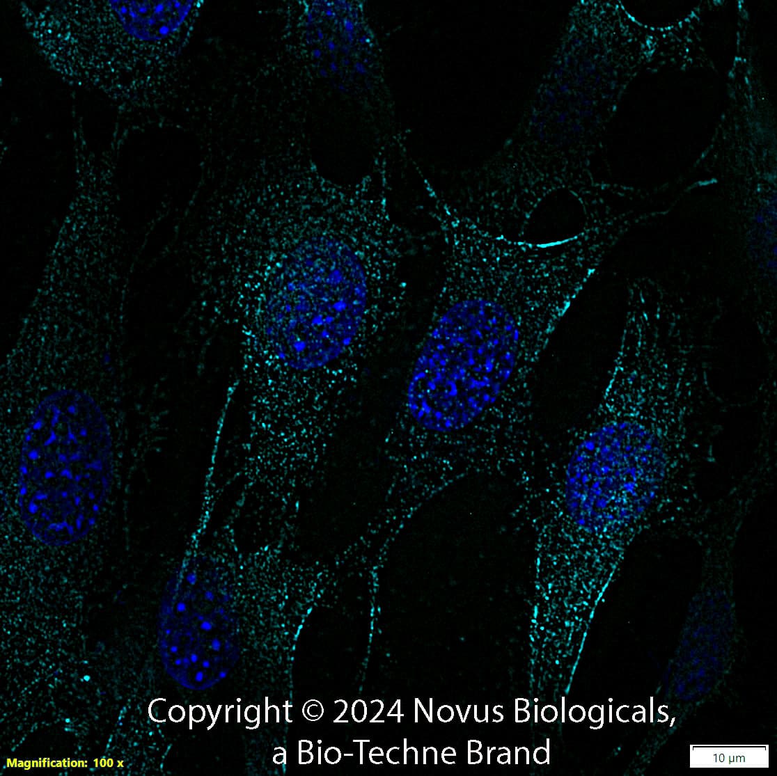 SLC31A1/CTR1 Antibody [DyLight 650]