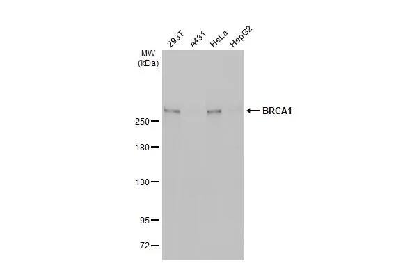 BRCA1 Antibody (6B4)