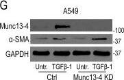 UNC13D/Munc 13-4 Antibody