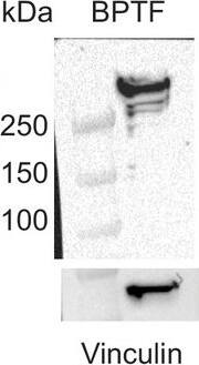 BPTF/FALZ Antibody