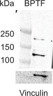 BPTF/FALZ Antibody
