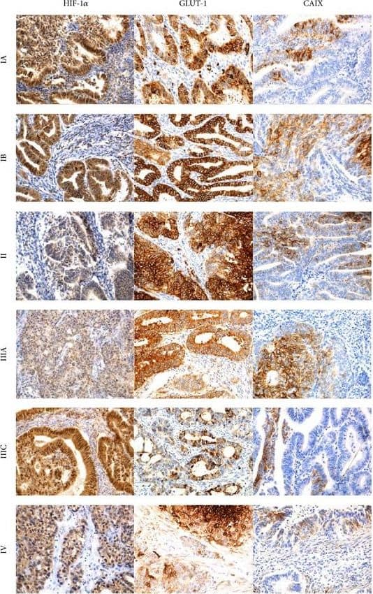 Carbonic Anhydrase IX/CA9 Antibody - BSA Free