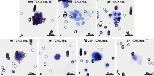 Carbonic Anhydrase IX/CA9 Antibody - BSA Free