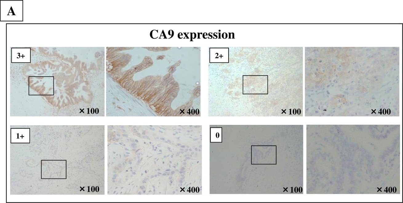 Carbonic Anhydrase IX/CA9 Antibody - BSA Free