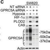 Carbonic Anhydrase IX/CA9 Antibody - BSA Free