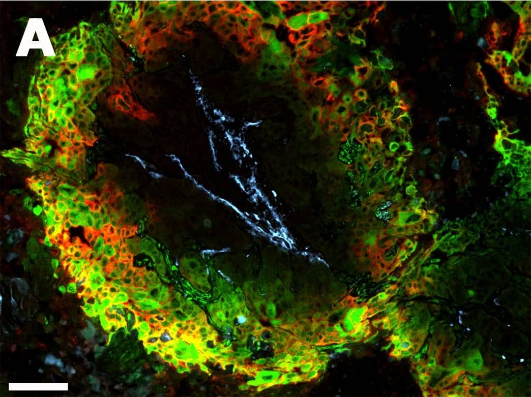 Carbonic Anhydrase IX/CA9 Antibody - BSA Free