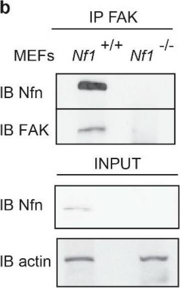 Neurofibromin 1 Antibody - BSA Free