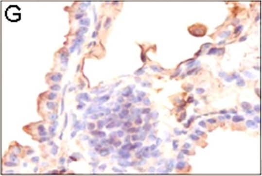 HIF-1 alpha Antibody