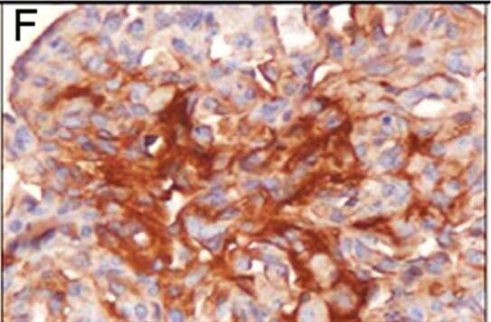 HIF-1 alpha Antibody