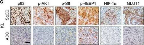 HIF-1 alpha Antibody