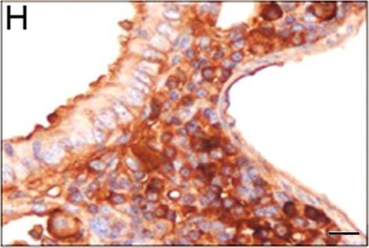 HIF-1 alpha Antibody