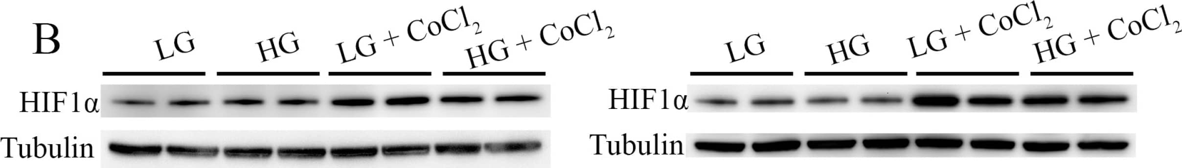 HIF-1 alpha Antibody
