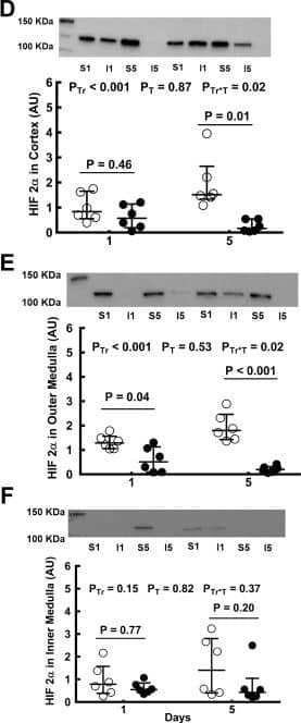HIF-1 alpha Antibody - BSA Free