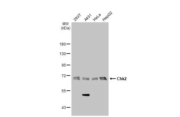 Chk2 Antibody (8F12)