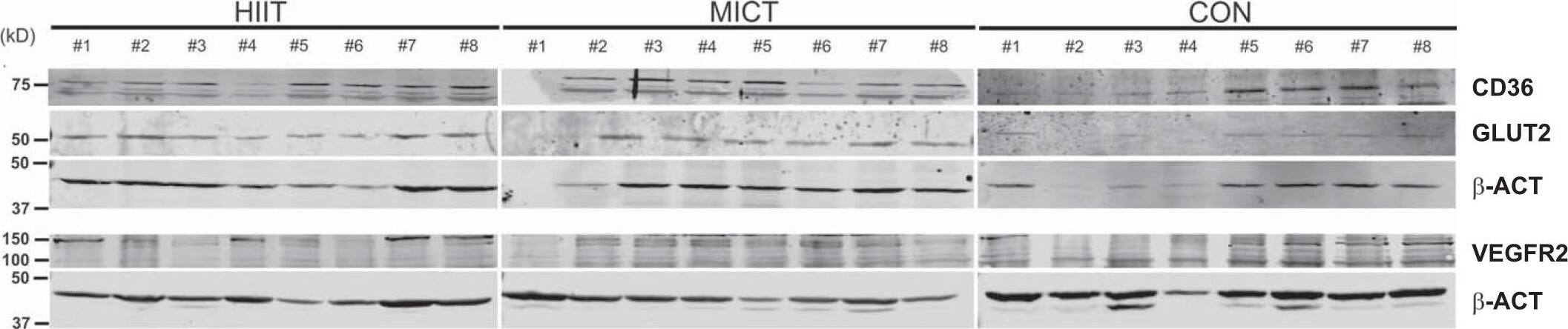 VEGFR2/KDR/Flk-1 Antibody