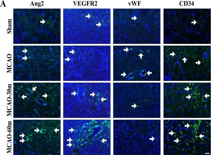 VEGFR2/KDR/Flk-1 Antibody - BSA Free