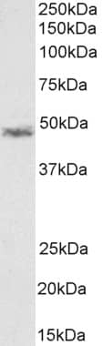 CCM2 Antibody