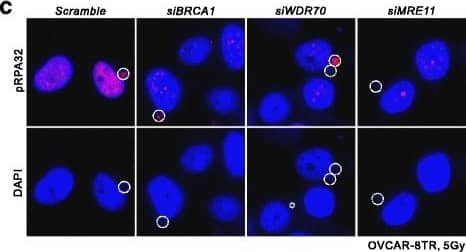 RPA2 [p Ser33] Antibody - BSA Free