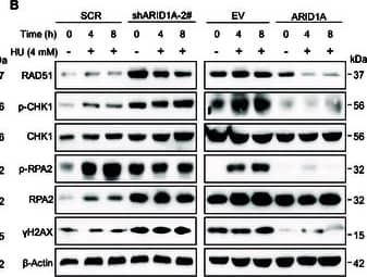RPA2 [p Ser33] Antibody - BSA Free