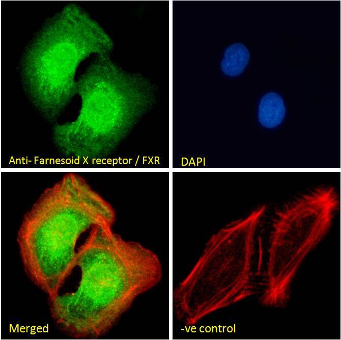 FXR/NR1H4 Antibody