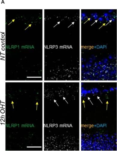 NLRP1/NALP1 Antibody