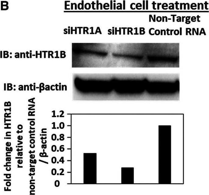5-HT1B Antibody - BSA Free