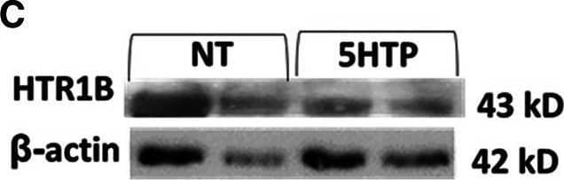 5-HT1B Antibody - BSA Free