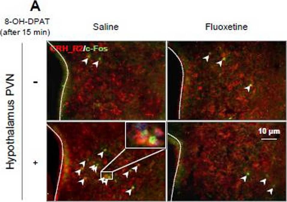 CRHR2/CRF2 Antibody - BSA Free