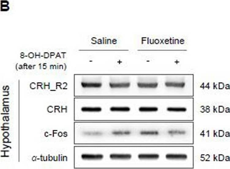 CRHR2/CRF2 Antibody - BSA Free