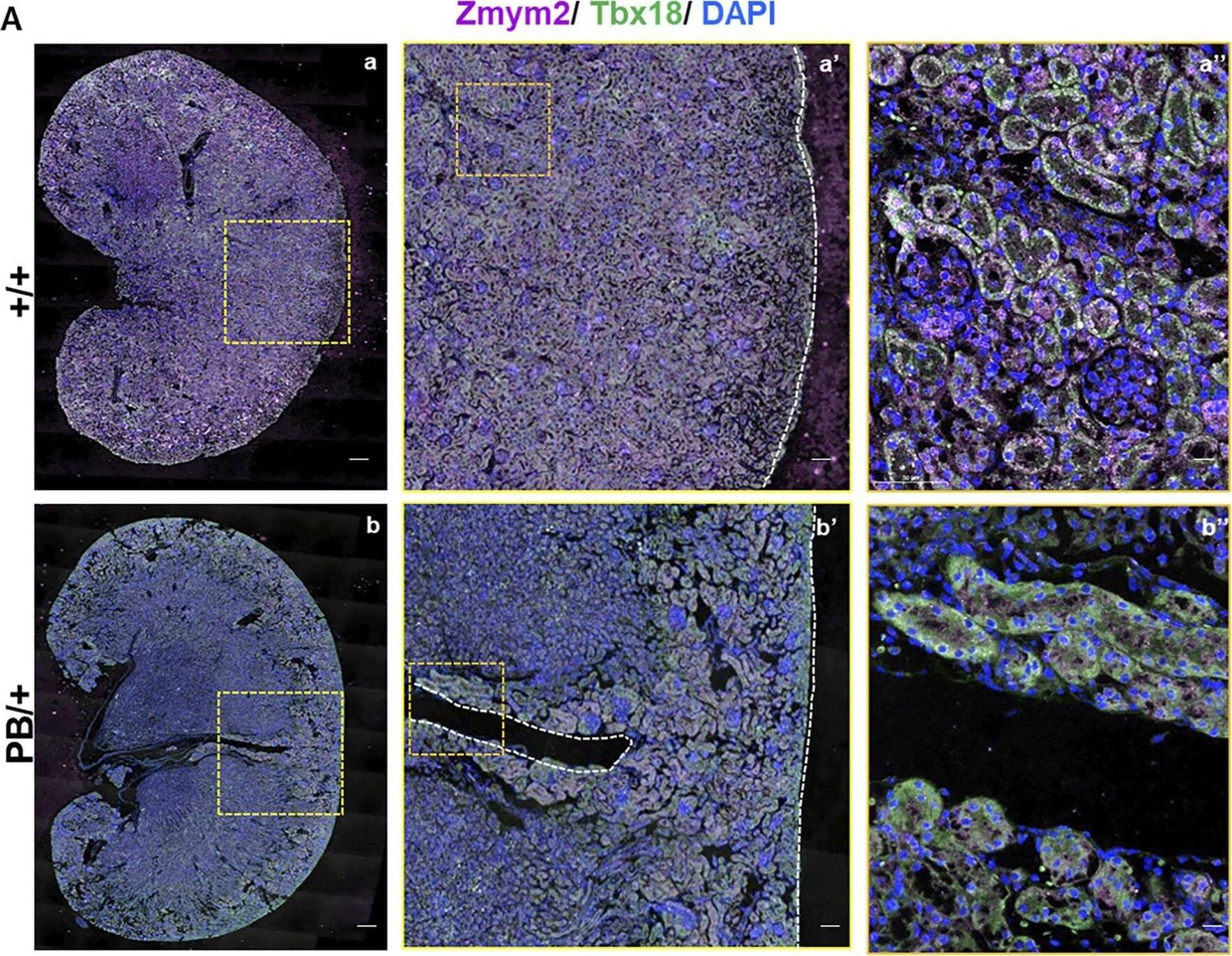 ZNF198 Antibody - BSA Free