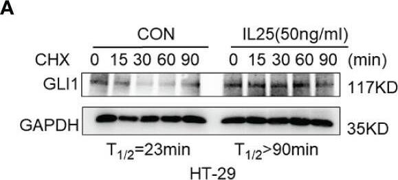 IL-17E/IL-25 Antibody (68C1039.2) - BSA Free