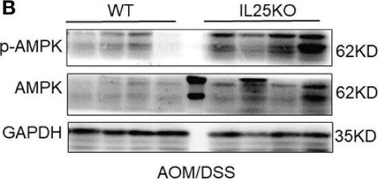 IL-17E/IL-25 Antibody (68C1039.2) - BSA Free