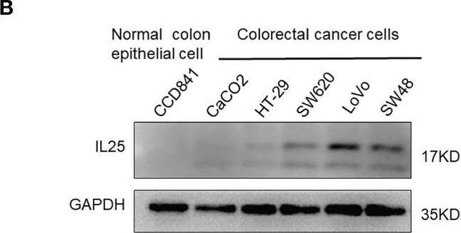 IL-17E/IL-25 Antibody (68C1039.2) - BSA Free