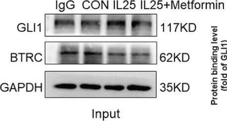 IL-17E/IL-25 Antibody (68C1039.2) - BSA Free