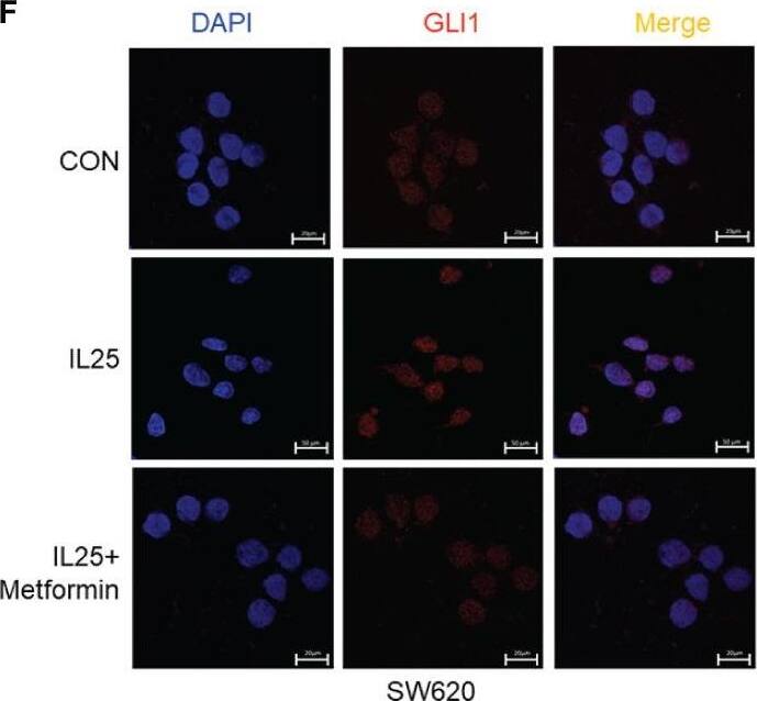 IL-17E/IL-25 Antibody (68C1039.2) - BSA Free