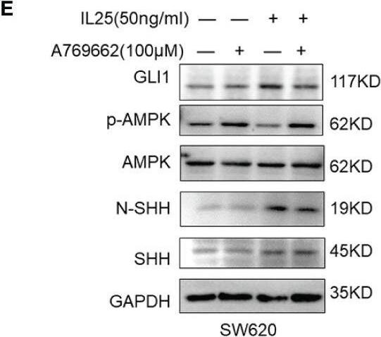 IL-17E/IL-25 Antibody (68C1039.2) - BSA Free