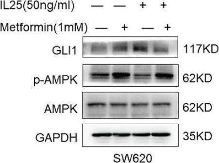 IL-17E/IL-25 Antibody (68C1039.2) - BSA Free