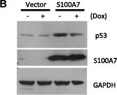 S100A7/Psoriasin Antibody (47C1068) - BSA Free
