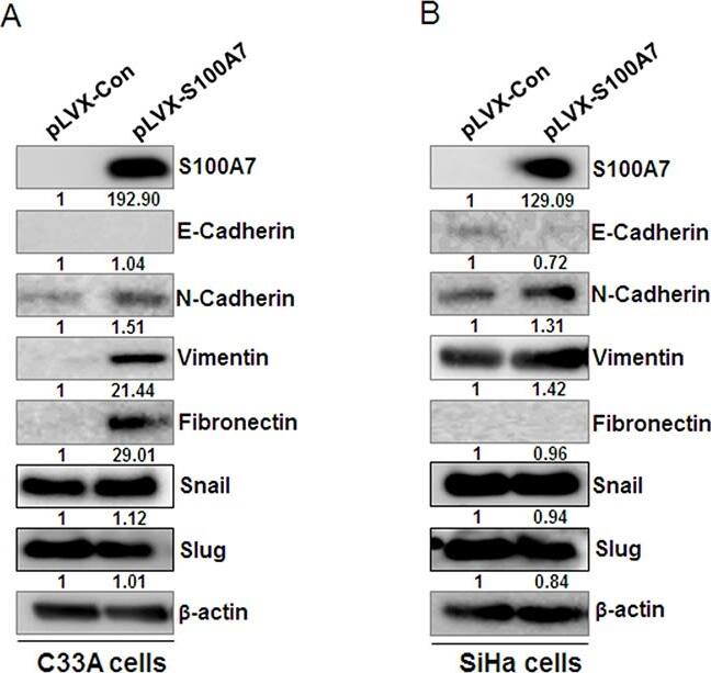 S100A7/Psoriasin Antibody (47C1068) - BSA Free