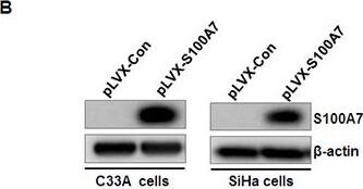 S100A7/Psoriasin Antibody (47C1068) - BSA Free